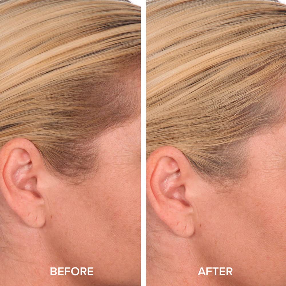 TRUHAIR Color & Conceal Waterproof Root Touch Up Hair Color Concealer - Hair Cover up for Gray Coverage and Hairline Filling - 11 Hair Colors Available