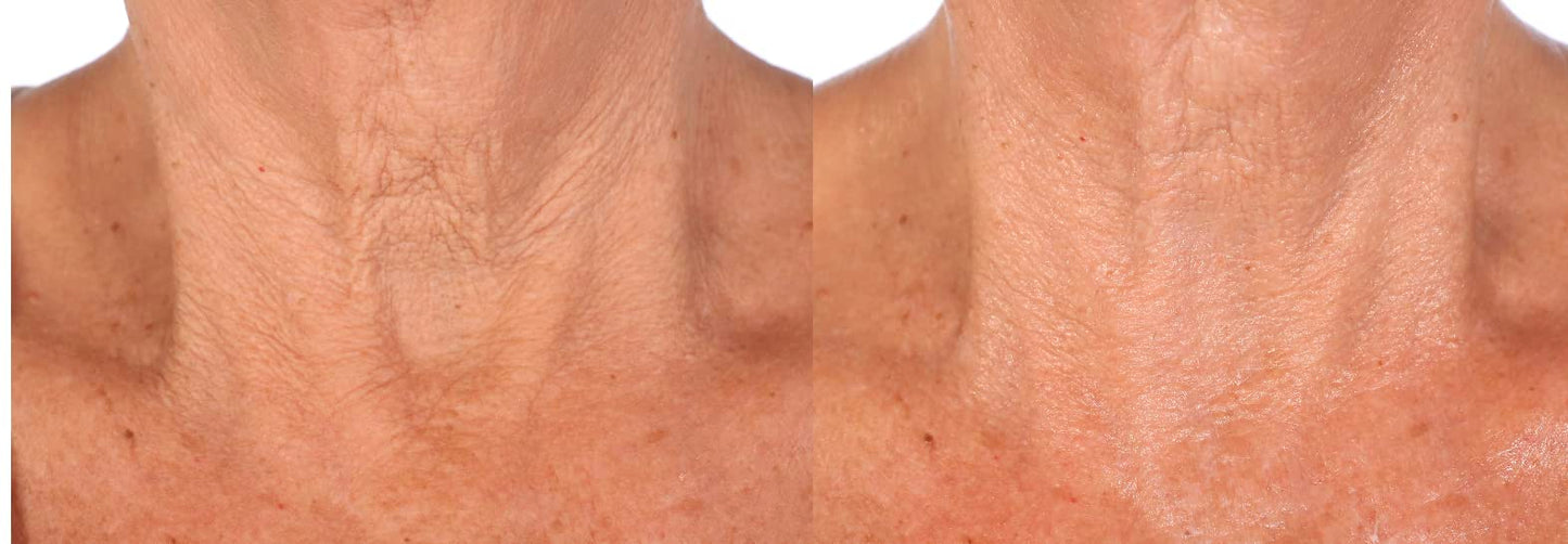 Nakery SkinToning Body Butter | Crepe Smoothing + Repair | Infused with Niacinamide, Caffeine, Tri-Hyaluronic Acid (Sparkling Celebrations)