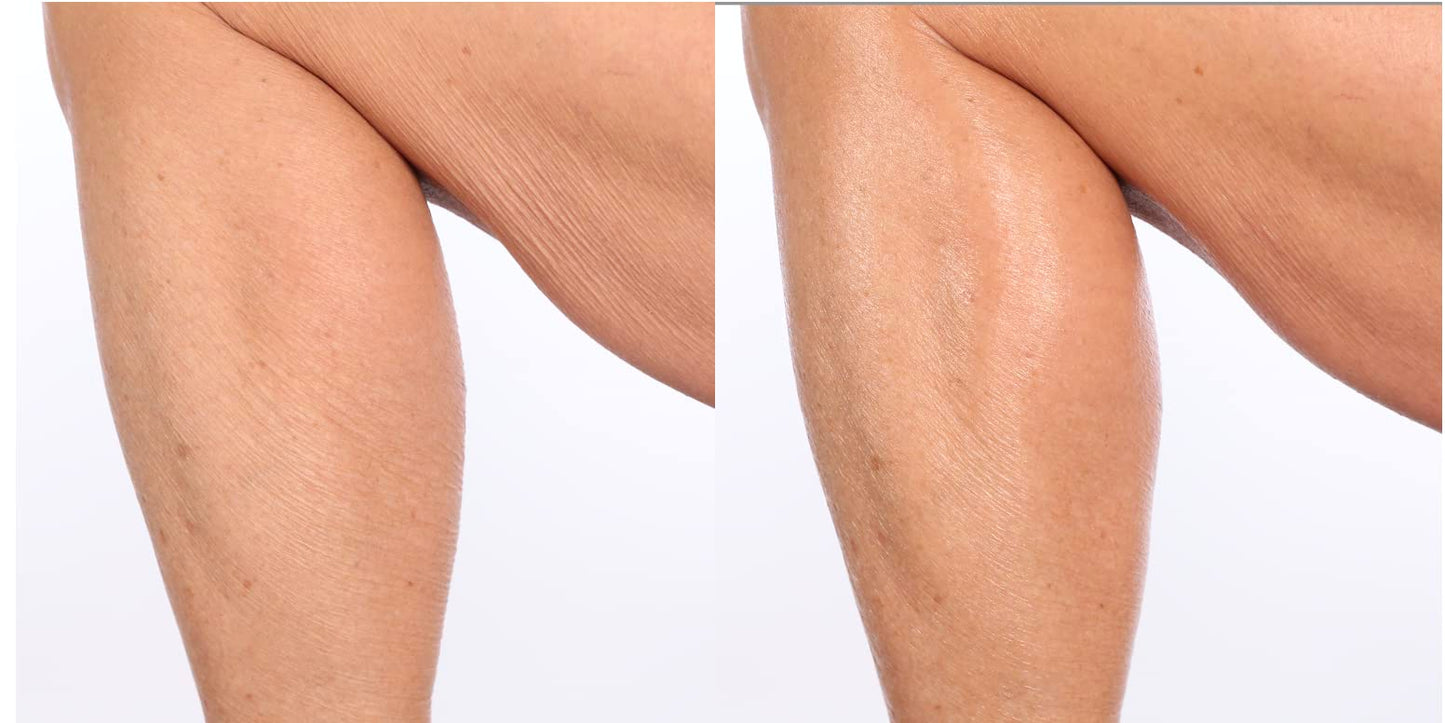 Nakery SkinToning Body Butter | Crepe Smoothing + Repair | Infused with Niacinamide, Caffeine, Tri-Hyaluronic Acid (Tropical Therapy)