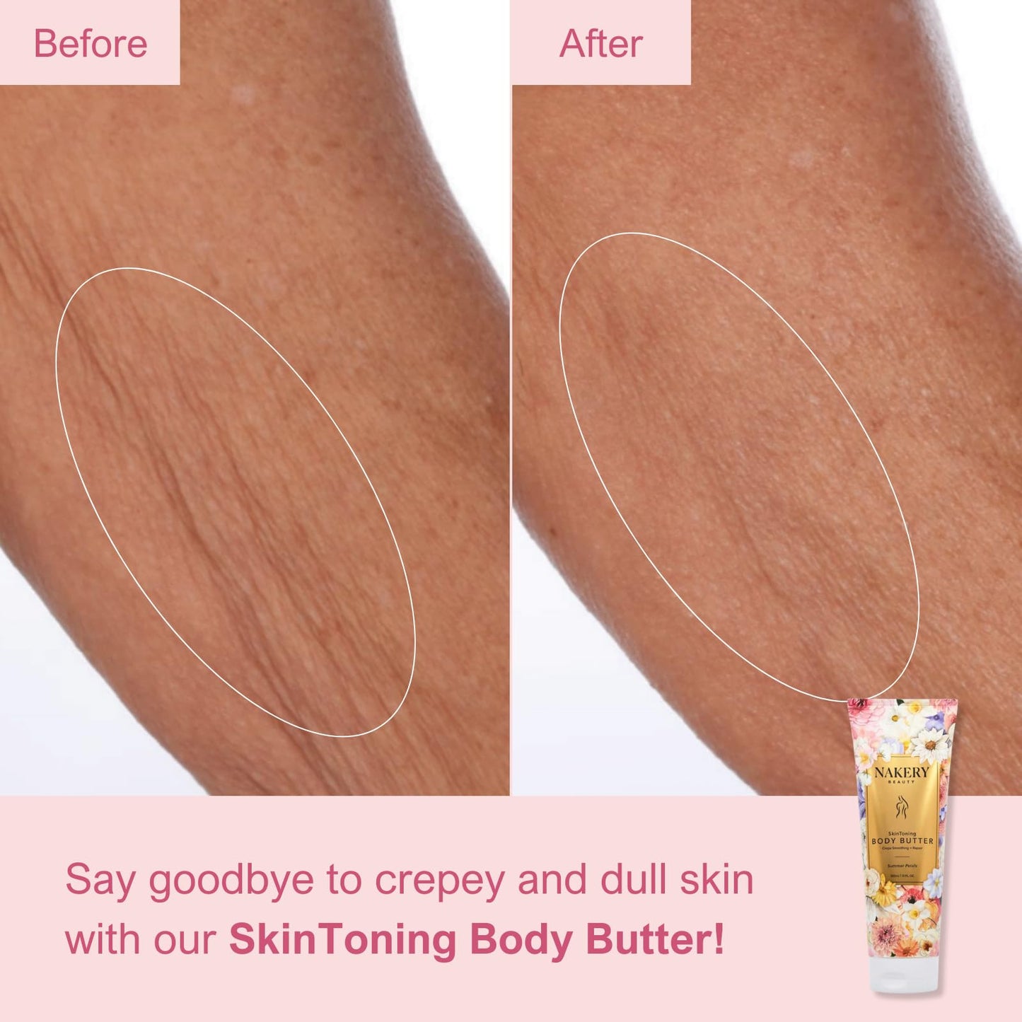 Nakery Body Butter Anti Aging Moisturizer - Body Cream Skin Tightening Cream & Neck Firming Cream, Moisturizing Cream & Neck Tightening Cream for Body & Face Cream for Dry Skin 300ml