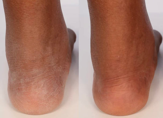 Nakery SkinRestore Body + Hand Wash | Ultra-Foaming | Reinvigorates the Skin | Sulfate-Free (Sparkling Celebrations)