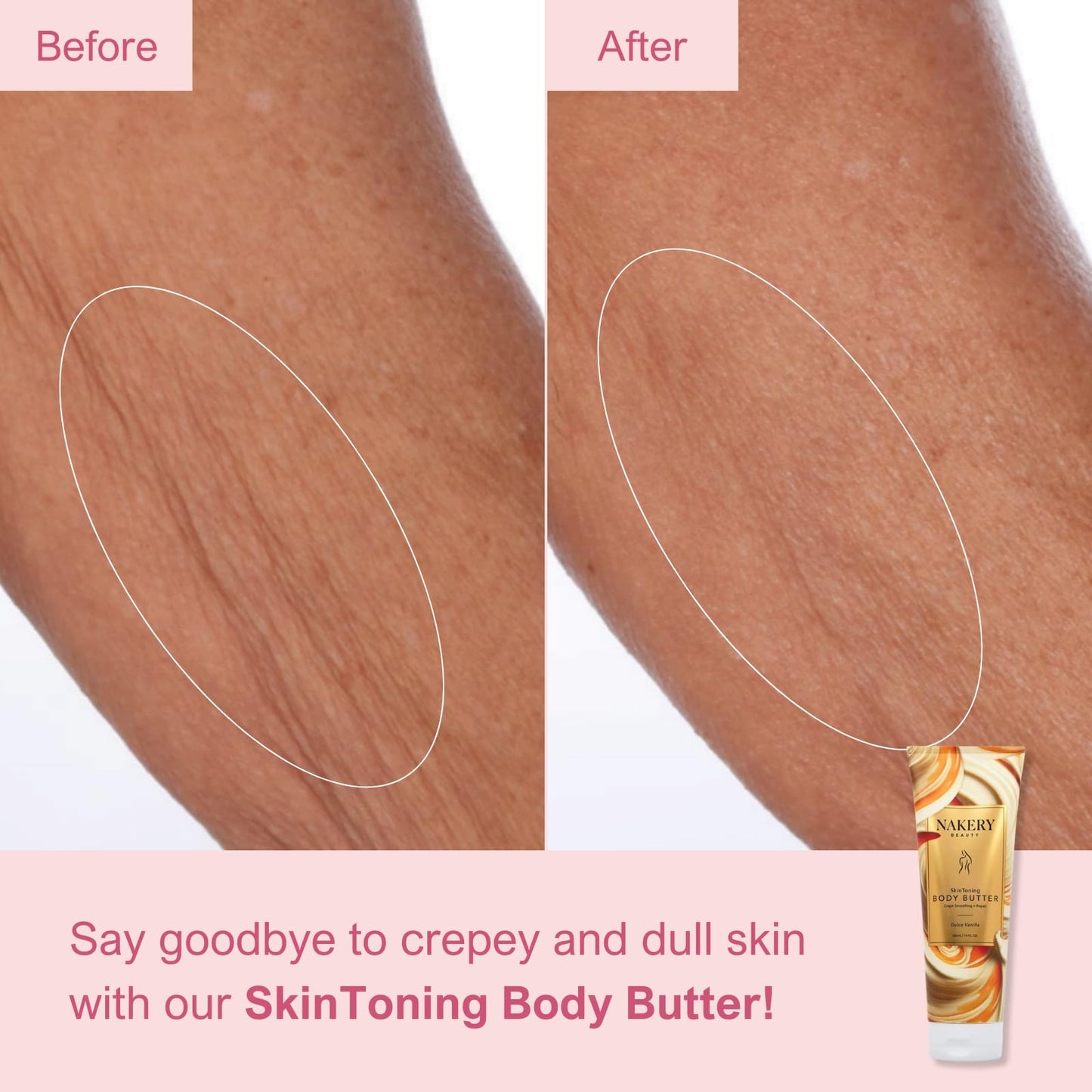 Nakery Body Butter Anti Aging Moisturizer - Body Cream Skin Tightening Cream & Neck Firming Cream, Moisturizing Cream & Neck Tightening Cream for Body & Face Cream for Dry Skin 300ml