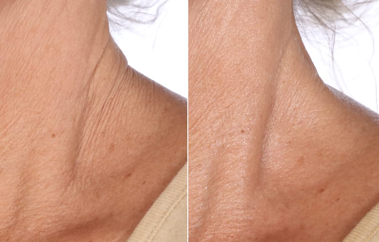 Nakery SkinToning Body Butter | Crepe Smoothing + Repair | Infused with Niacinamide, Caffeine, Tri-Hyaluronic Acid (Sparkling Celebrations)