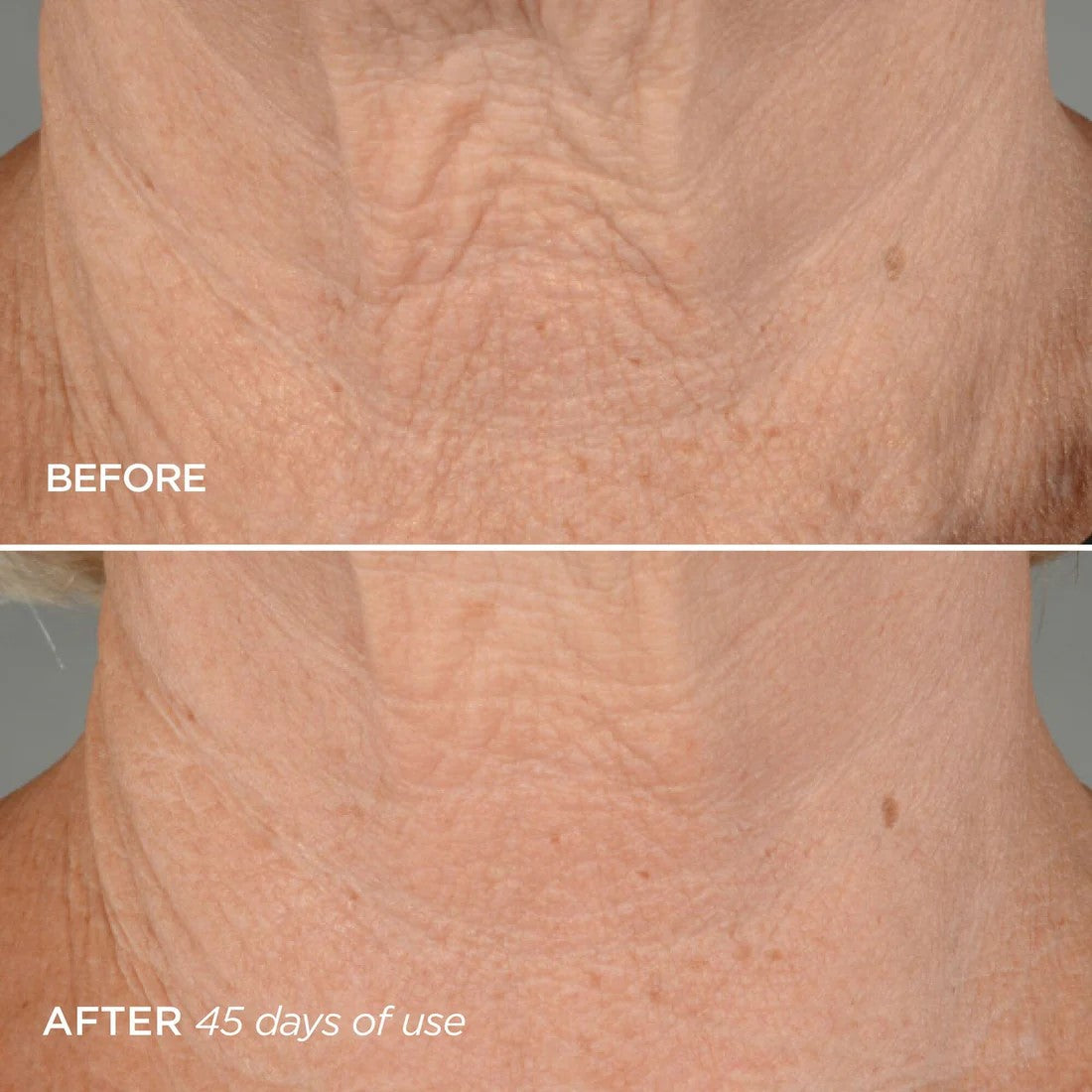 BEAUTYBIO THE LIFT PHASE 4 NECK FIRMING CONCENTRATE