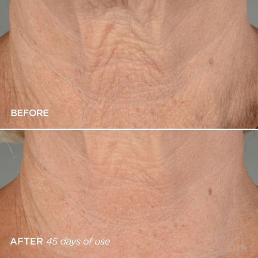 BEAUTYBIO THE LIFT PHASE 4 NECK FIRMING CONCENTRATE