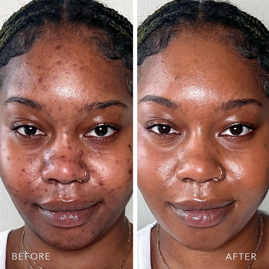 Doll 10 TCE Liquid Filter - Covers, Blurs, and Brightens