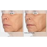 Signature Club A 5 Essentials Creme for Face and Eyes with Plant Stem Cell Complex