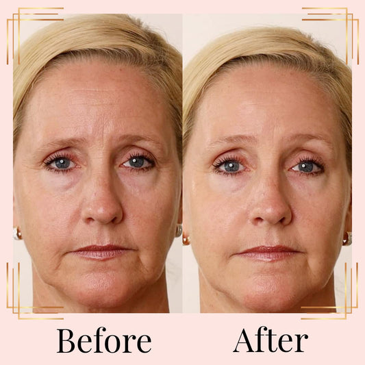 Nakery Retinol Eye Cream - Anti Wrinkle Face Cream with Hyaluronic Acid Face Tightening Serum - Wrinkle Cream for Under Eye - Instant Wrinkle Remover Serum 50ml