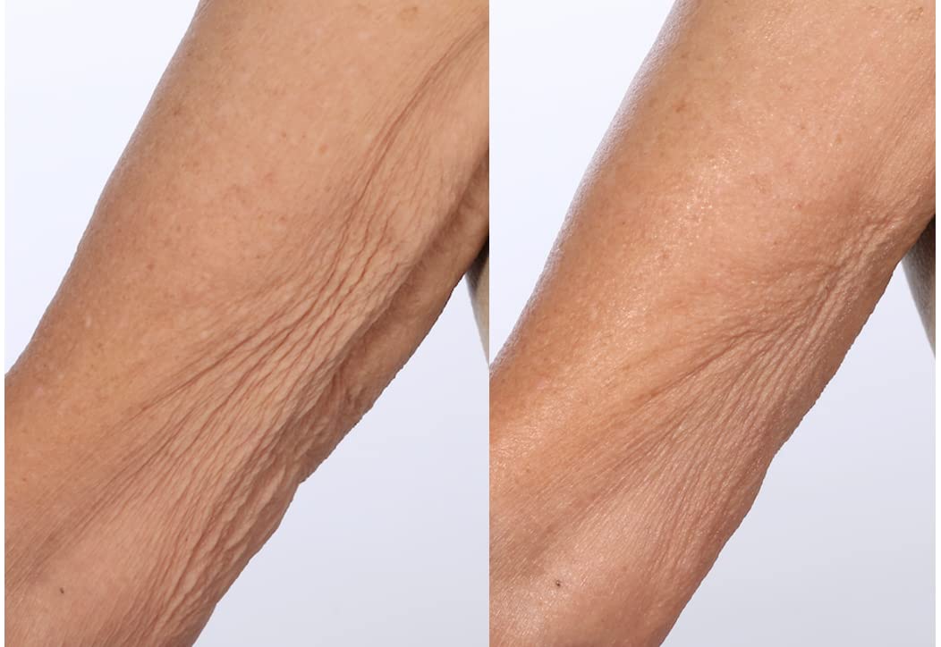 Nakery SkinToning Body Butter | Crepe Smoothing + Repair | Infused with Niacinamide, Caffeine, Tri-Hyaluronic Acid (Tropical Therapy)
