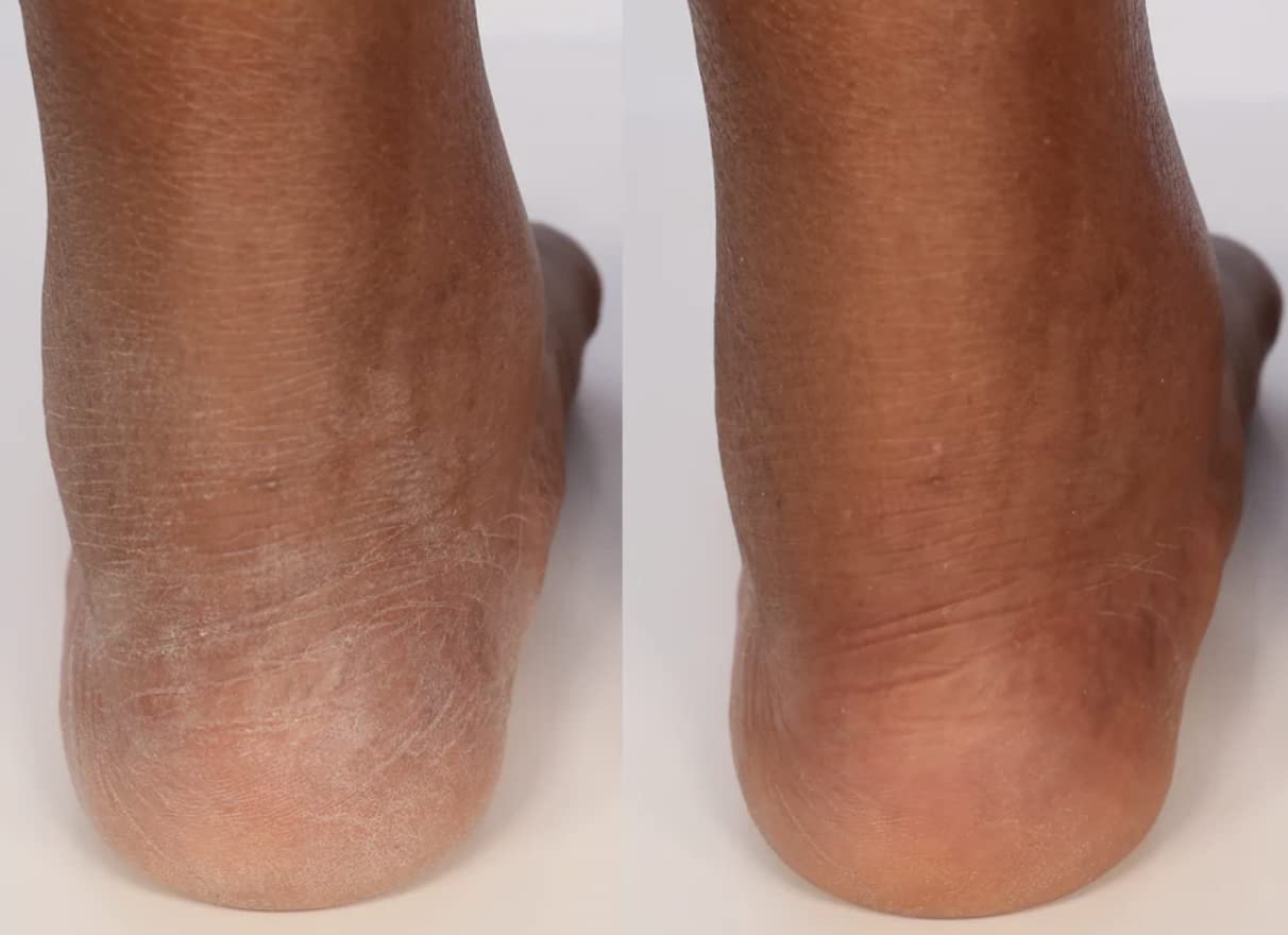 Nakery SkinRestore Body + Hand Wash | Ultra-Foaming | Reinvigorates the Skin | Sulfate-Free (Sparkling Celebrations)