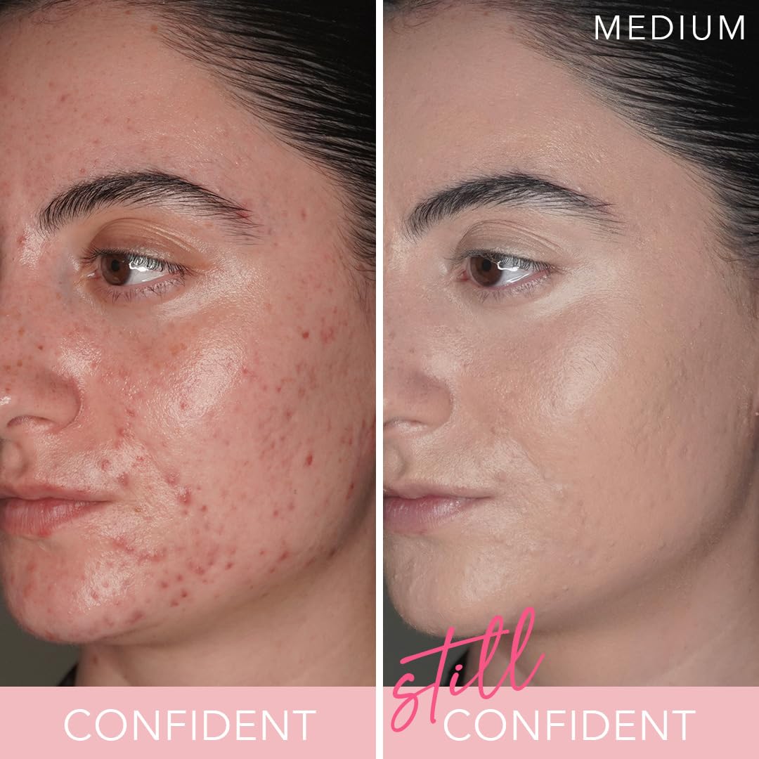 T.C.E This Covers Everything Super Coverage Serum Makeup with Peptides - Skincare/Makeup Hybrid Full Coverage Color Correcting